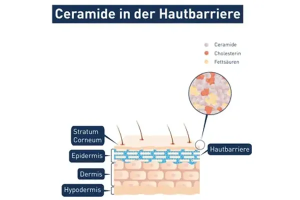 Grafik über den Gehalt von Ceramiden und anderen Lipiden in der Haut